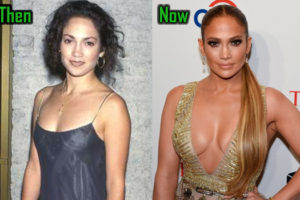 Jennifer Lopez Plastic Surgery: Nose Job, Boob Job, Before-After!