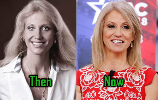 Conway Kellyanne Facelift Before Surgery Plastic Botox Lift Then Eye Skin.