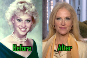Kellyanne Conway Plastic Surgery: Facelift, Botox, Before-After Photos!