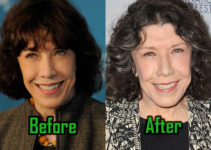 Lily Tomlin Plastic Surgery, Facelift, Botox, Before-After Photos!