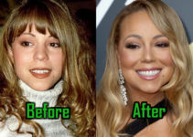Mariah Carey Plastic Surgery: Nose Surgery & Boob Job? Before-After!
