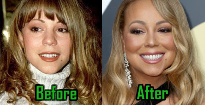 Mariah Carey Plastic Surgery Photo