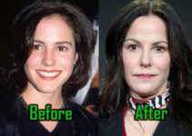 Mary Louise Parker: Plastic Surgery For Facelift, Nose Job, Before-After!