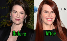 Megan Mullally Plastic Surgery