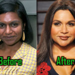 Mindy Kaling Plastic Surgery