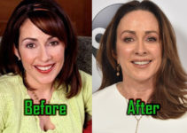 Patricia Heaton Plastic Surgery: Botox, Boob Job, Before-After Photos!