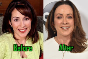 Patricia Heaton Plastic Surgery: Botox, Boob Job, Before-After Photos!