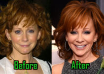 Reba McEntire: Plastic Surgery Rejuvenates Her Face, Boobs! Before-After!