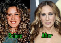Sarah Jessica Parker: Plastic Surgery for Boobs and Nose! Before-After!