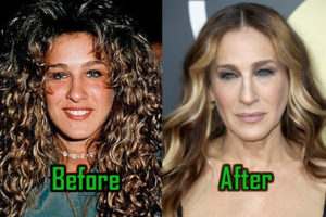 Sarah Jessica Parker: Plastic Surgery for Boobs and Nose! Before-After!