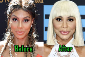 Tamar Braxton Plastic Surgery: Nose Job, Fillers, Before-After Photos!