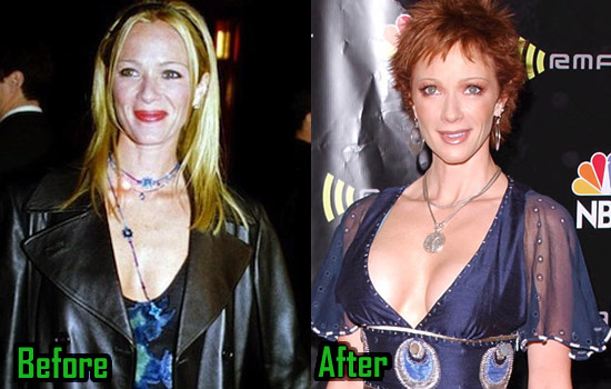 Pictures of Lauren Holly Breasts Augmentation