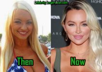 How Lindsey Pelas Plastic Surgery Transforms Her Look!