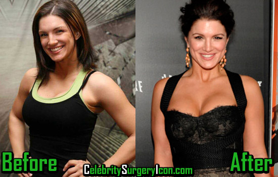 Gina Carano Plastic Surgery Boob Job Rumor Before And After Celebritysurgeryicon 