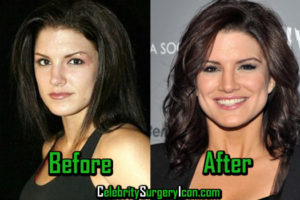 Gina Carano Plastic Surgery, Before and After