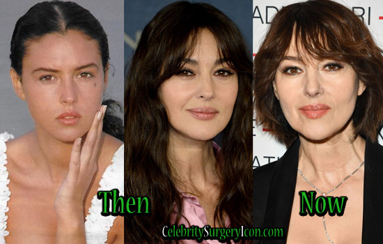 Monica Bellucci Plastic Surgery Before After