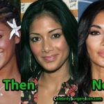 Nicole Scherzinger Plastic Surgery, Nose Lips Job, Then and Now Pictures
