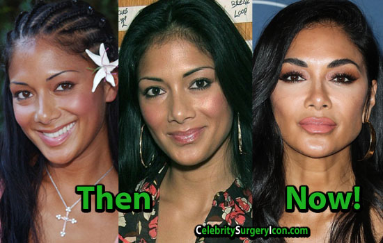 Nicole Scherzinger Plastic Surgery, Nose Lips Job, Then and Now  Pictures