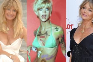 Goldie Hawn Plastic Surgery: Before and After Her Facelift