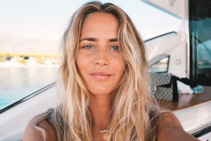 Janni Deler’s Boob Job – Before And After Images