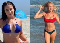 Lizzy Wurst’s Boob Job – Before And After Images