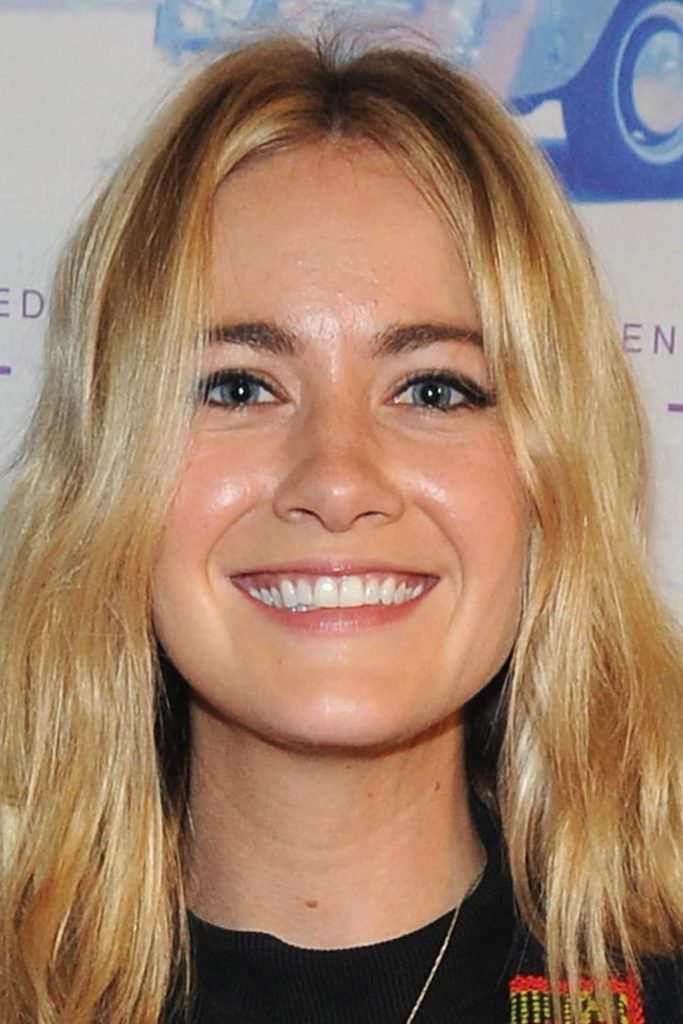 Meredith Hagner Cosmetic Surgery Face