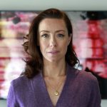 Molly Parker Plastic Surgery