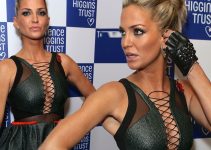 Has Sarah Harding Had Plastic Surgery? Body Measurements and More!