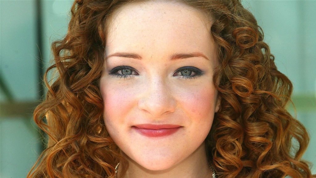 Scarlett Pomers Cosmetic Surgery Face