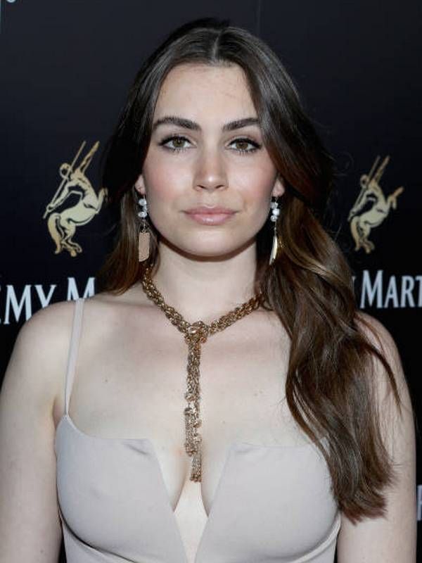 Sophie Simmons Cosmetic Surgery Face