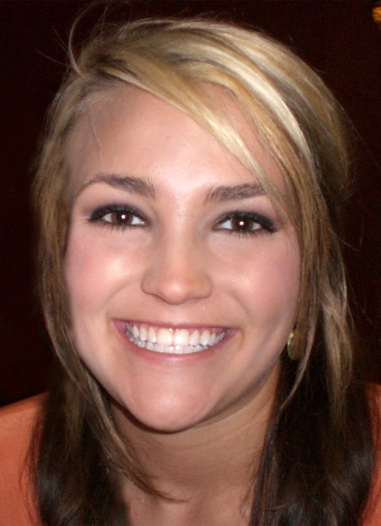 Jamie Lynn Spears Cosmetic Surgery Face