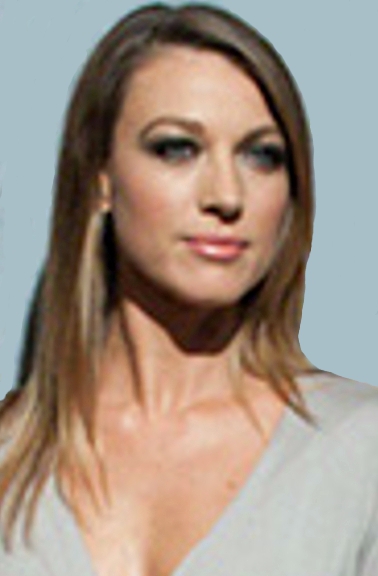Natalie Zea Cosmetic Surgery Face