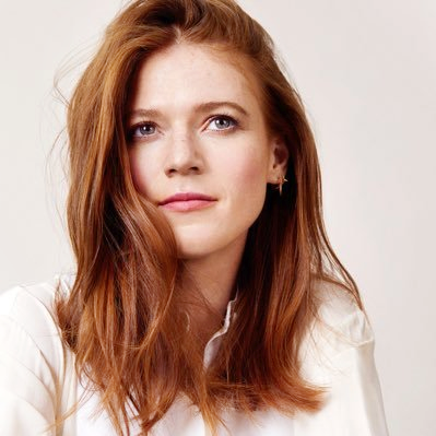 Rose Leslie Cosmetic Surgery Face