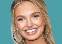 What Plastic Surgery Has Romee Strijd Done?