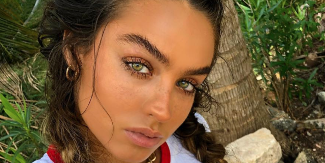 Sommer Ray Cosmetic Surgery Face