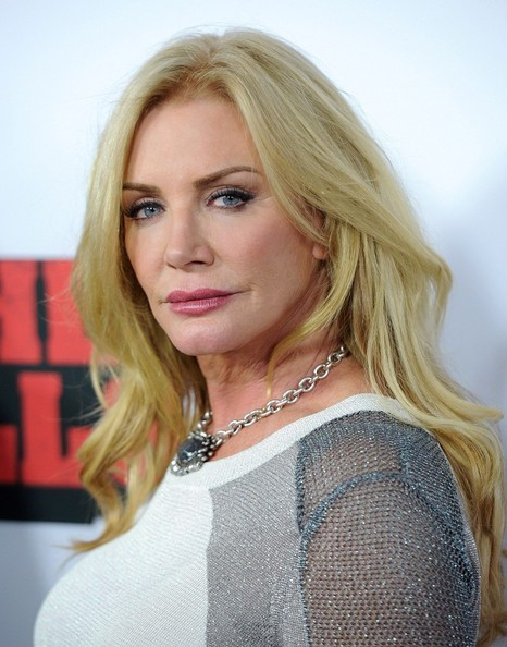 Shannon Tweed Facelift Plastic Surgery
