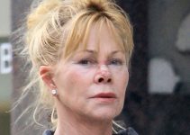 Did Melanie Griffith Have Plastic Surgery? Everything You Need To Know!