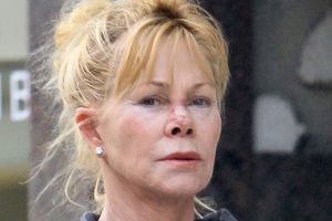 Did Melanie Griffith Have Plastic Surgery? Everything You Need To Know!