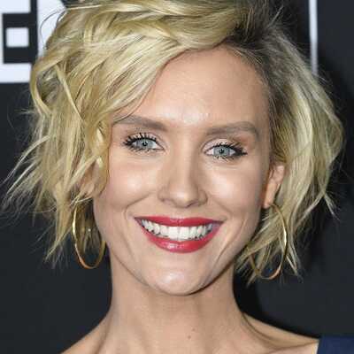 Nicky Whelan Cosmetic Surgery Face