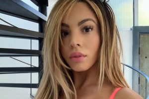 Danielley Ayala’s Plastic Surgery – What We Know So Far