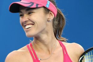 Did Martina Hingis Have Plastic Surgery? Everything You Need To Know!