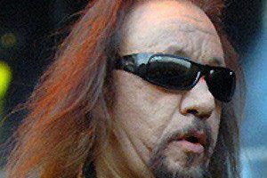 Did Ace Frehley Have Plastic Surgery? Everything You Need To Know!