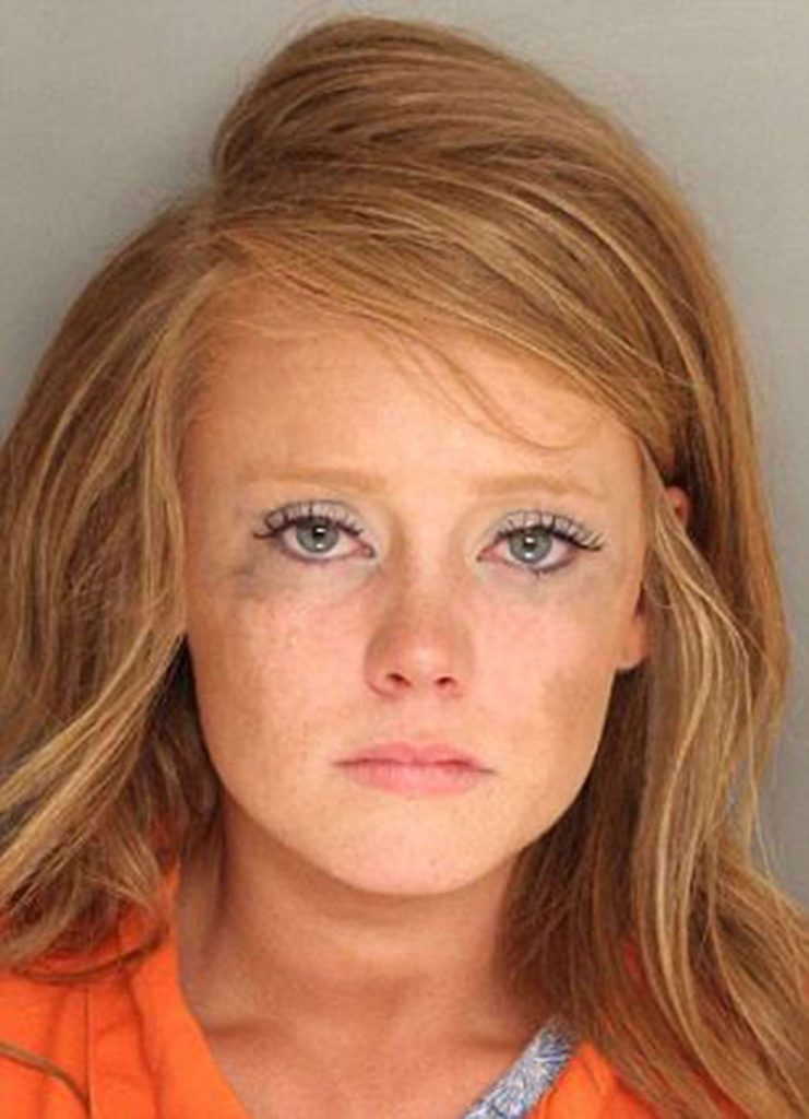 Kathryn Dennis Cosmetic Surgery Face