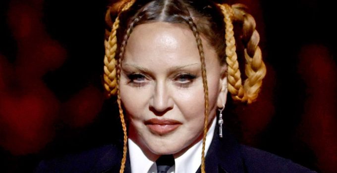 Madonna Cosmetic Surgery