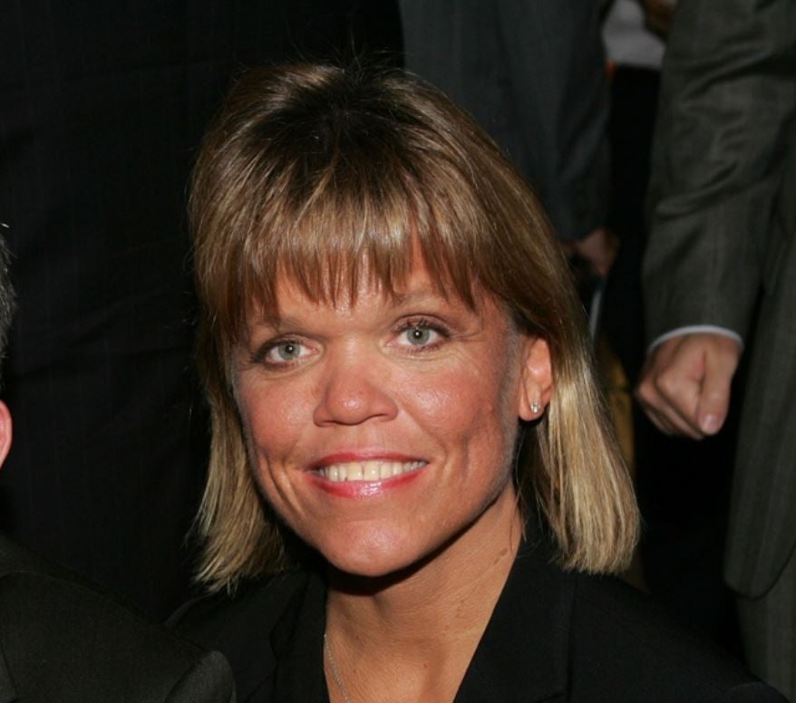 Amy Roloff Cosmetic Surgery Face