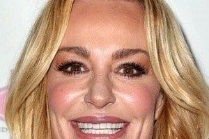 Did Taylor Armstrong Have Plastic Surgery? Everything You Need To Know!