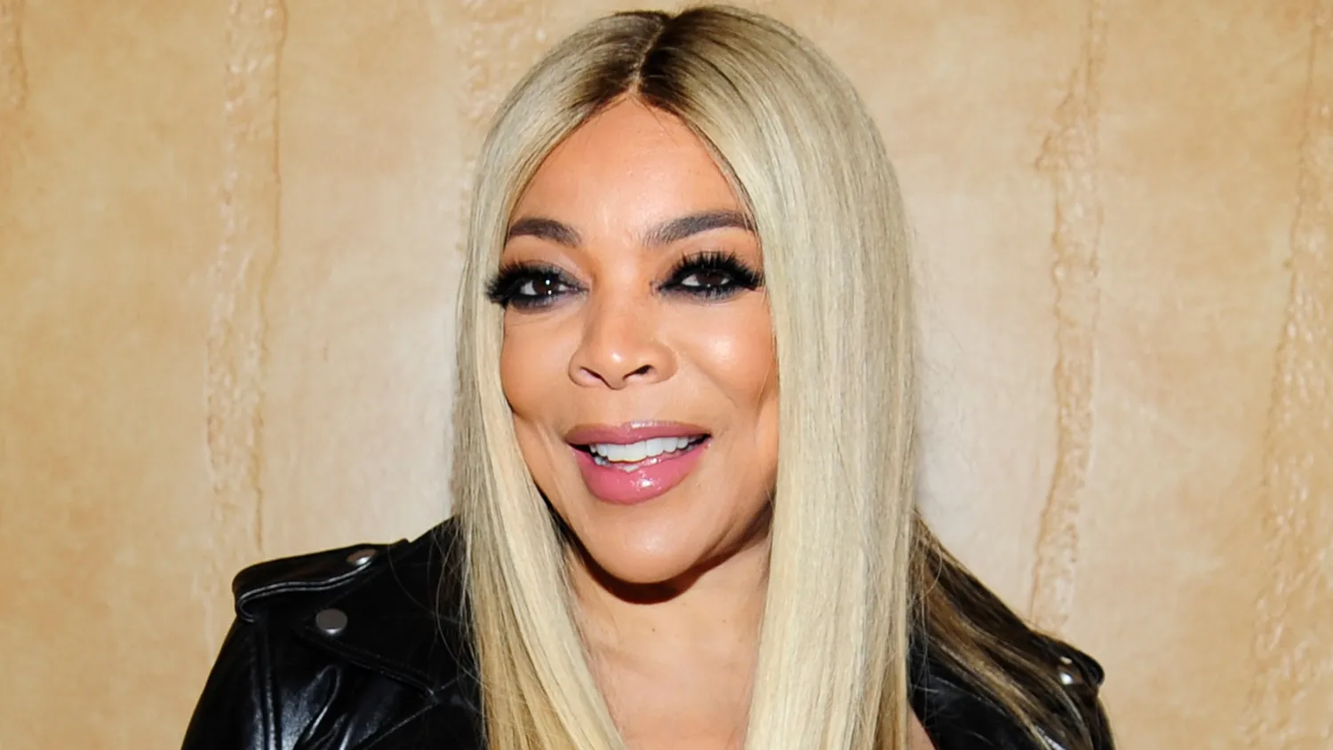 Wendy Williams: The Plastic Surgery Stories - CelebritySurgeryIcon
