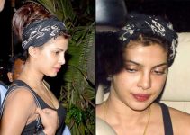 Priyanka Chopra’s Plastic Surgery Journey: Unveiling Rumors and Facts