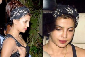 Priyanka Chopra’s Plastic Surgery Journey: Unveiling Rumors and Facts