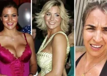 Gemma Atkinson’s Bold Take on Breast Enlargement and Dismissal of Botox